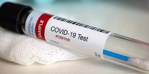 அதிகபட்ச கொரோனா பரிசோதனை கட்டணம் ரூ.4,500 - தனியார் ஆய்வகங்களுக்கு அரசு உத்தரவு