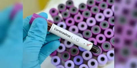 தமிழகத்தில் மேலும் 3 பேருக்கு கொரோனா பாதிப்பு