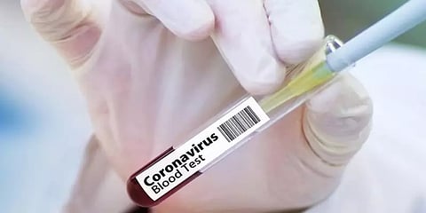 இந்தியாவில் கொரோனாவுக்கு உயிரிழப்பு 17 ஆக உயர்வு: பாதிப்பும் அதிகரிப்பு