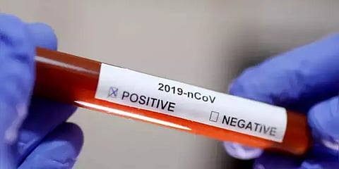 கோவையில் பெண் மருத்துவருக்கு கொரோனா : பணியாற்றிய மருத்துவமனைக்கு சீல்