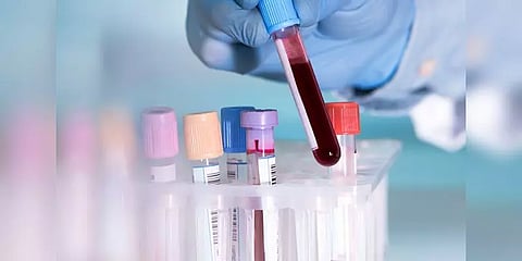 அமெரிக்காவில் தொடங்கிய கொரோனா எதிர்ப்பு சக்தியை கண்டறியும் முறை