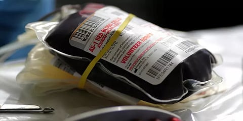 ரத்த மாற்று மூலம் கொரோனாவை வீழ்த்த முடியுமா ? விரைவில் சோதனை முயற்சி