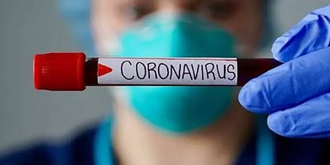 ஐசிஎம்ஆர் அங்கீகாரம் பெற்ற ரேபிட் கிட்களை தமிழக அரசு ஏன் வாங்கவில்லை -தருமபுரி எம்பி