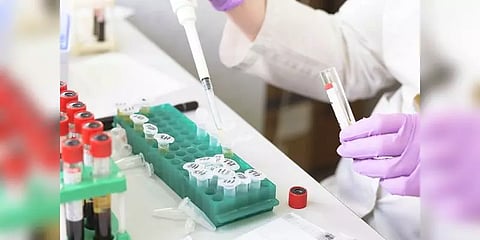 ஊரடங்கில் பெற்றோருக்குத் தெரியாமல் 1,500 கிமீ பயணம் - மருத்துவ மாணவரின் வியக்க வைத்த சேவை