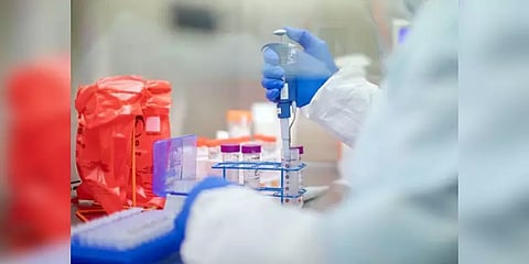 ஒரு ரேபிட் கிட்டின் விலை ரூ.600 - தமிழக அரசு பதில்