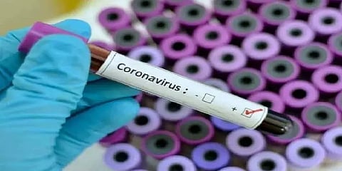 சென்னை: ஊரடங்கு ரோந்து பணியில் இருந்த காவலருக்கு கொரோனா தொற்று!