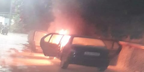 கீழ்ப்பாக்கம் மருத்துவமனை வளாகத்தில் தீப்பிடித்து எரிந்த கார்: போலீசார் விசாரணை