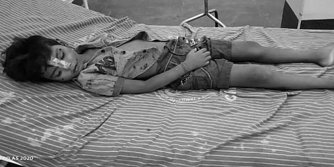 உடல் முழுவதும் காயத்துடன் சிறுவன் மரணம்..! - தகாத உறவால் கொடூரம்..?