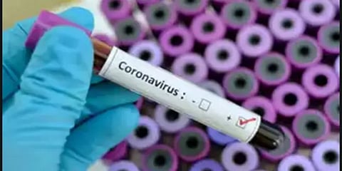 பிறந்து ஒரு வாரமான குழந்தைக்கு கொரோனா : கோவையில் சோகம்