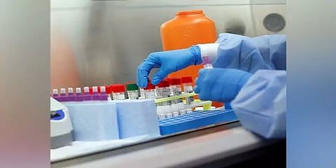 ரேபிட் டெஸ்ட் கருவியில் தவறான முடிவு - கொரோனா பரிசோதனையை நிறுத்திய ராஜஸ்தான்
