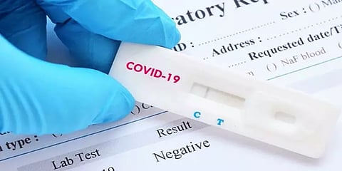கொரோனாவை கண்டறிய பிசிஆர் டெஸ்ட் அவசியம் - ஐசிஎம்ஆர் விளக்கம்