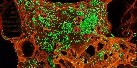 ''கொரோனாவை கட்டுப்படுத்தும் சூரிய ஒளி'' - ஆய்வில் தகவல் !