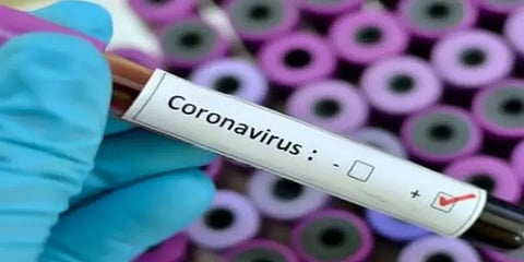 கொரோனா: கடந்த 24 மணிநேரத்தில் இந்தியாவில் 83 பேர் உயிரிழப்பு