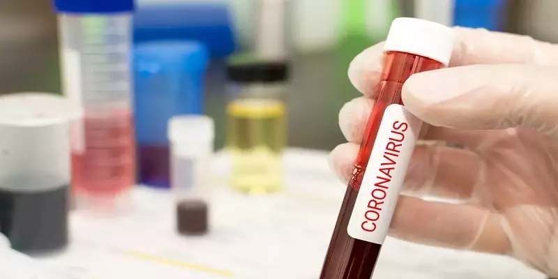 கொரோனாவுக்கு மருந்து கண்டுபிடிக்க முயற்சி - சோடியம் நைட்ரேட் கரைசலை உட்கொண்டவர் உயிரிழப்பு