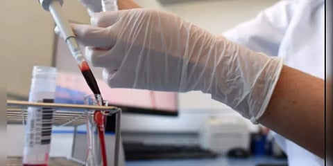 தமிழகத்தில் பிளாஸ்மா சிகிச்சை சோதனைக்கு அனுமதி : சுகாதாரத்துறை இணைச் செயலர்