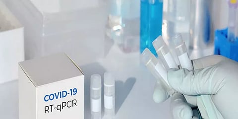 வந்தடைந்த 1 லட்சம் RT - PCR கருவிகள்: 10 லட்சம் கருவிகள் முன்பதிவு: தீவிரமாகவுள்ள பரிசோதனை