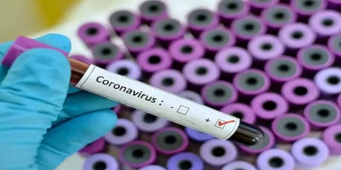 சென்னை: ராயபுரம் மண்டலத்தில் 1,272 பேருக்கு கொரோனா