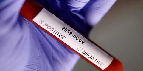 இந்தியாவில் கொரோனா பாதிப்பு 1,31,868 ஆக உயர்வு - இரண்டாவது இடத்தில் தமிழகம்