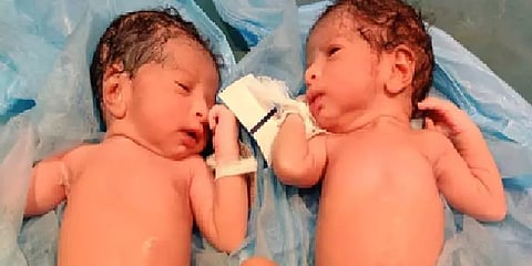 கொரோனா பாதித்த கர்ப்பிணிக்கு ஒரே பிரசவத்தில் இரட்டை குழந்தைகள்!!