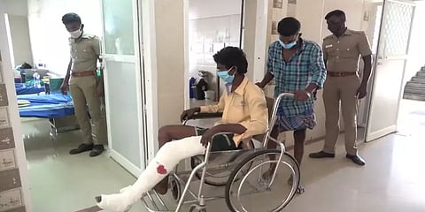 சங்கிலிப் பறிப்பில் ஈடுபட்ட மூவர் - மாவு கட்டுடன் மருத்துவமனையில் அனுமதி