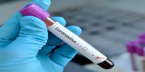 உலகளவில் கொரோனா பாதிப்பு 61.50 லட்சத்தை தாண்டியது..!