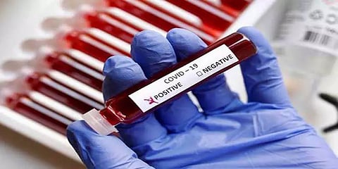 தபால் நிலைய ஊழியருக்கு கொரோனா: மூடப்பட்ட அலுவலகம்