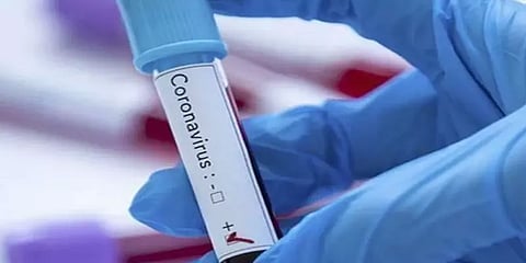 மாப்பிள்ளைக்கு கொரோனா : தனிமைப்படுத்தப்பட்ட 63 பேர்!