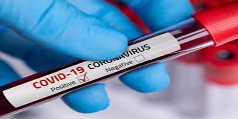 அயனாவரம் காவல் நிலையத்தில் 15 பேருக்கு கொரோனா !