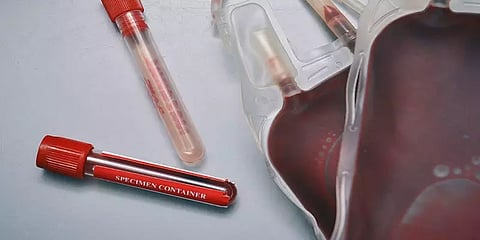 தமிழகத்தில் சில தினங்களில் பிளாஸ்மா சிகிச்சை - சுகாதாரத்துறை