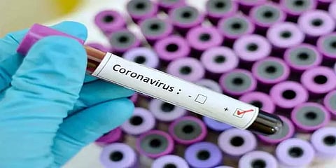 பிலிப்பைன்ஸ் நாட்டில் மருத்துவம் படித்துவிட்டு வந்த 24 வயது வாலிபர் கொரோனாவால் உயிரிழப்பு