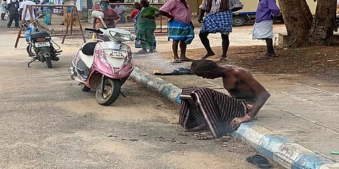 திண்டுக்கல்: மது போதையில் வனத்துறை அலுவலக உதவியாளர் தீக்குளிப்பு