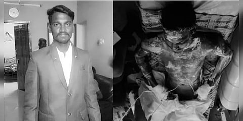 பைக்கை பிடிங்கிய காவலர்கள்: கெஞ்சியும் கொடுக்காததால் விரக்தியில் தீக்குளித்த இளைஞர்..!