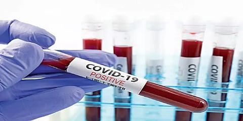 இந்தியாவில் ஒரே நாளில் 4.2 லட்சத்துக்கும் அதிகமான கோவிட் பரிசோதனைகள் !