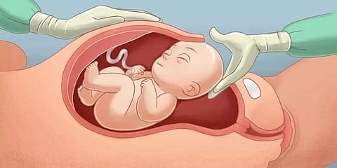 குறையும் சுகப்பிரசவம்: விதிகளை மீறி தனியார் மருத்துவமனைகளில் அறுவைசிகிச்சையா?