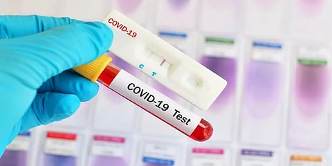 புதுச்சேரி: கொரோனா தொற்று உறுதியானவர்கள் குடும்பத்துடன் தலைமறைவு