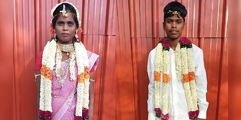 ’வரதட்சணைக்காக என் கணவரே தீ வைத்து கொளுத்தினார்’ காதல் மனைவியின் அதிர்ச்சி வாக்குமூலம்