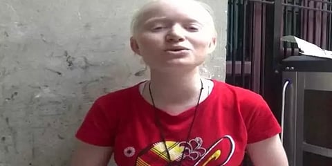 எனக்கு வெறும் 2 மதிப்பெண் தானா?  மறுகூட்டலில் 100 பெற்ற மாற்றுத்திறன் மாணவி