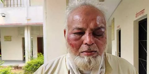 ”‘மோடி ஜிந்தாபாத்’ ‘ஜெய் ஸ்ரீ ராம்’ என கோஷமிடு” மறுத்த இஸ்லாமியர் மீது கொடூர தாக்குதல்