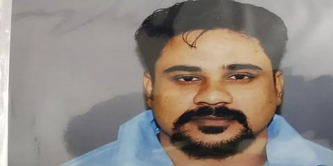 கை, கால்களில் நீல நிறம் - அங்கொட லொக்காவின் பிரேத பரிசோதனை அறிக்கை