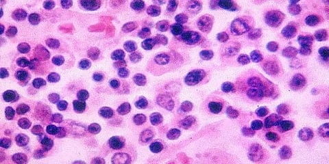 டைபாய்டு காய்ச்சல் - சால்மோனெல்லா பாக்டீரியா எப்படி பரவுகிறது? எவ்வாறு கண்டறிவது?