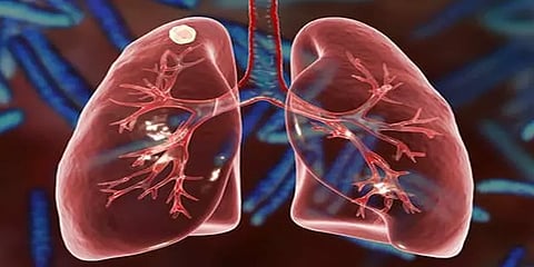 ஒரு மணிநேரத்தில் 'புனே - ஹைதராபாத்' கொண்டு செல்லப்பட்ட நுரையீரல் - அறுவை சிகிச்சை வெற்றி