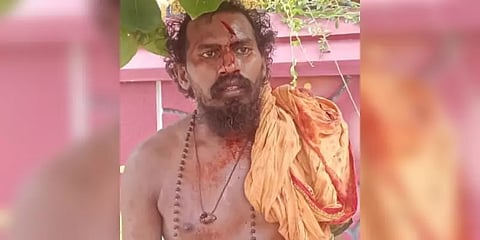 அமெரிக்க பெண்ணின் வீட்டில் நுழைந்து பாலியல் வன்கொடுமை செய்ய முயன்ற சாமியார்