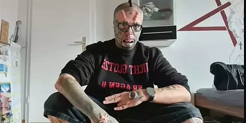 காதுகளை அகற்றிய ஜெர்மனி நபர் - காஸ்மெட்டிக் சர்ஜரிக்கு இப்படியா அடிமையாவது!!