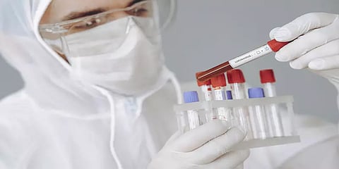 பெங்களூரிலிருந்து காஷ்மீருக்கு விமானம் வழியாக பறந்த பிளாஸ்மா