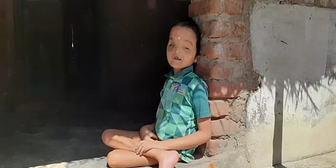 பிறந்தது முதல் இன்றுவரை பால்பவுடரை மட்டுமே உணவாக உட்கொள்ளும் 20வயது இளைஞர்...!