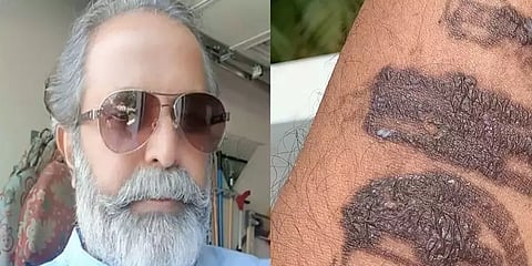 விமான நிலைய அடையாள மையால் கையில் அலர்ஜி - காங்கிரஸ் தலைவர் மது யாஸ்கி புகார்