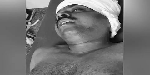 ஊராட்சி ஒன்றிய உறுப்பினரை இரும்புக் கம்பியால் தாக்கிய மர்ம கும்பல்...