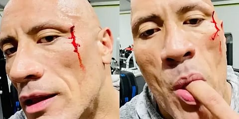 முகத்தில் வழிந்த ரத்தத்தை ருசி பார்த்த தி ராக் ! மிரட்டல் வீடியோ