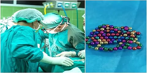 5 வயது சிறுவனின் வயிற்றில் 123 காந்த மணிகள்... பெற்றோரின் அலட்சியத்தால் நிகழ்ந்த விபரீதம்!