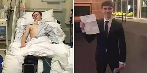 கொரோனா’ன்னா என்ன..? 11 மாத கோமாவுக்கு பின் மீண்ட இளைஞரின் கேள்வியால் திணறிய டாக்டர்கள்!